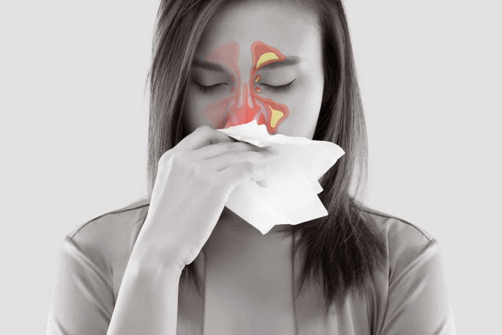 Sinusitis Treatment with Balloon Sinuplasty