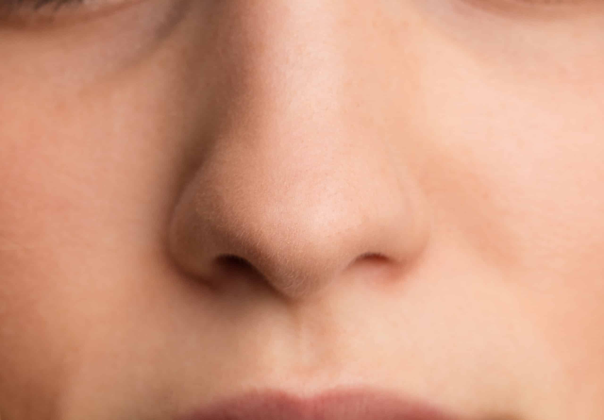 Teenager's,Nose,Close,Up